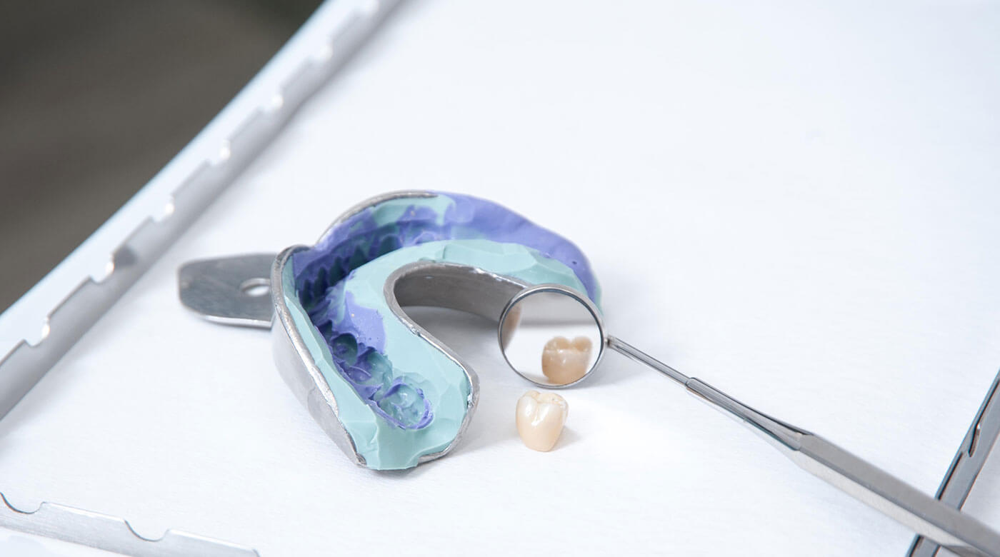 Foto zur Seite: Zahnersatz – Zentrum für Zahn & Chirurgie in Langen