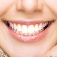 Strahlend weiße, gesunde Zähne einer Frau. 